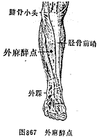外麻点