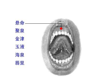 悬命