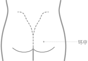 环中