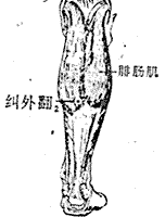 纠外翻 