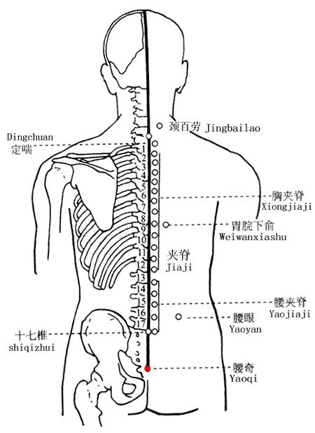 腰奇