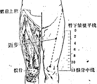 迈步